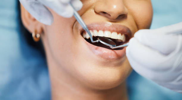 Best Emergency Dental Care for Broken or Chipped Teeth in New Whiteland, IN